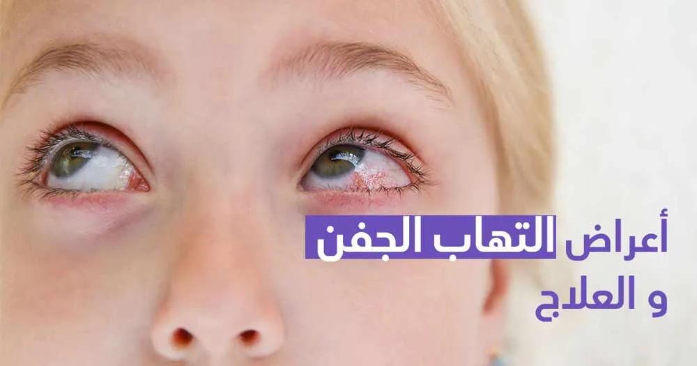 أعراض التهاب الجفن والعلاج